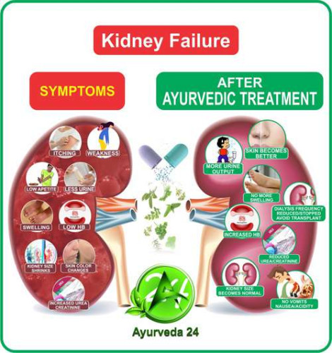 Ayurvedic Medicine for Kidney Failure